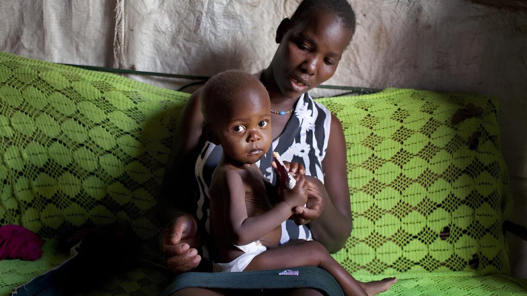 bayi afrika yang kekurangan gizi mengakibatkan stunting